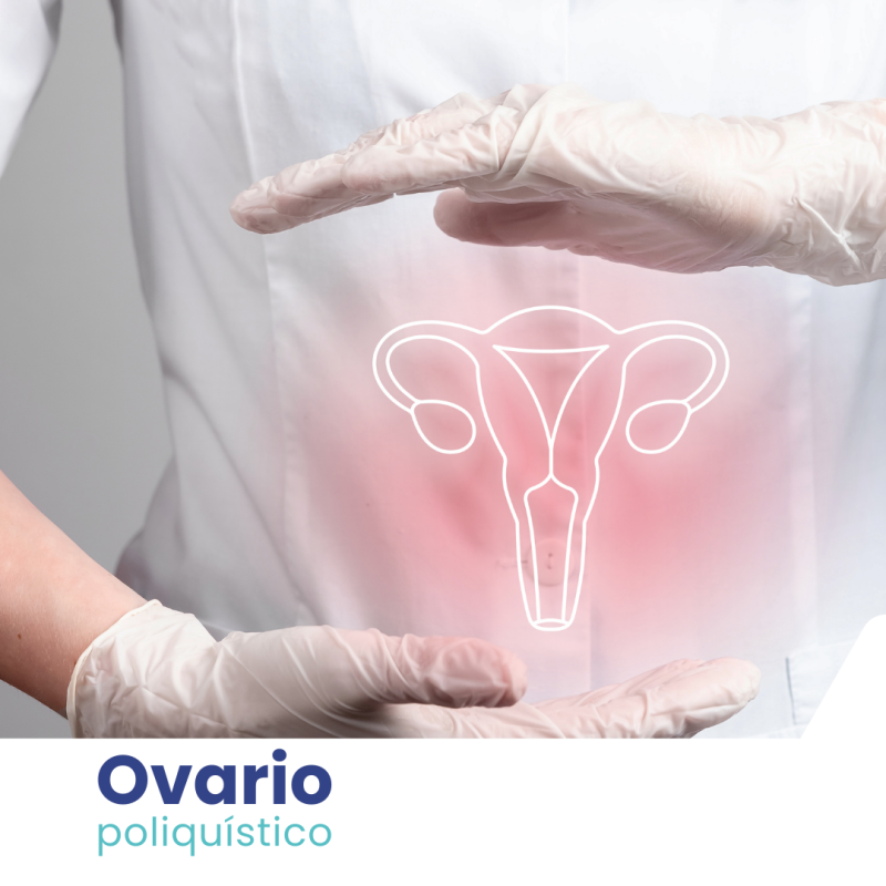 Control de Ovario Poliquístico